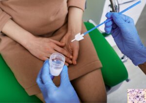 pap smear